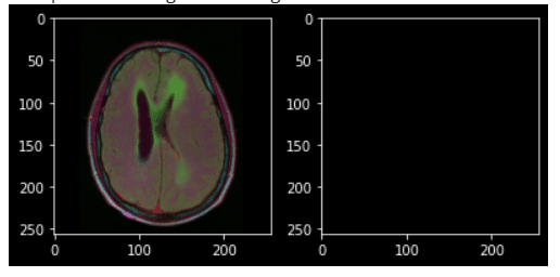 Segmenting Brain MRI Images using Python, TensorFlow, and Keras